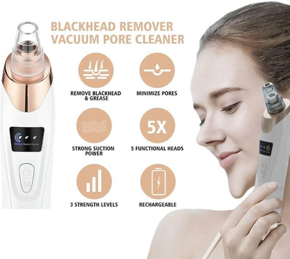 Electric Blackhead Remover
